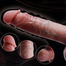 PRÓTESE GIANCARLO - SOBE E DESCE COM CONTROLE REMOTO